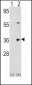 Thrombopoietin (TPO) Antibody (Center)